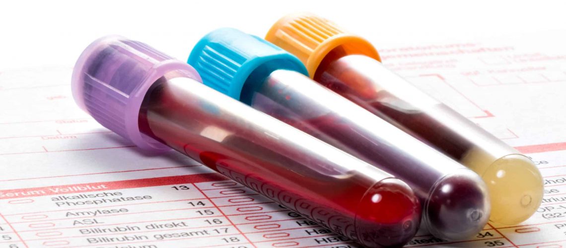 Blood samples are on a laboratory form for Finding out the blood values